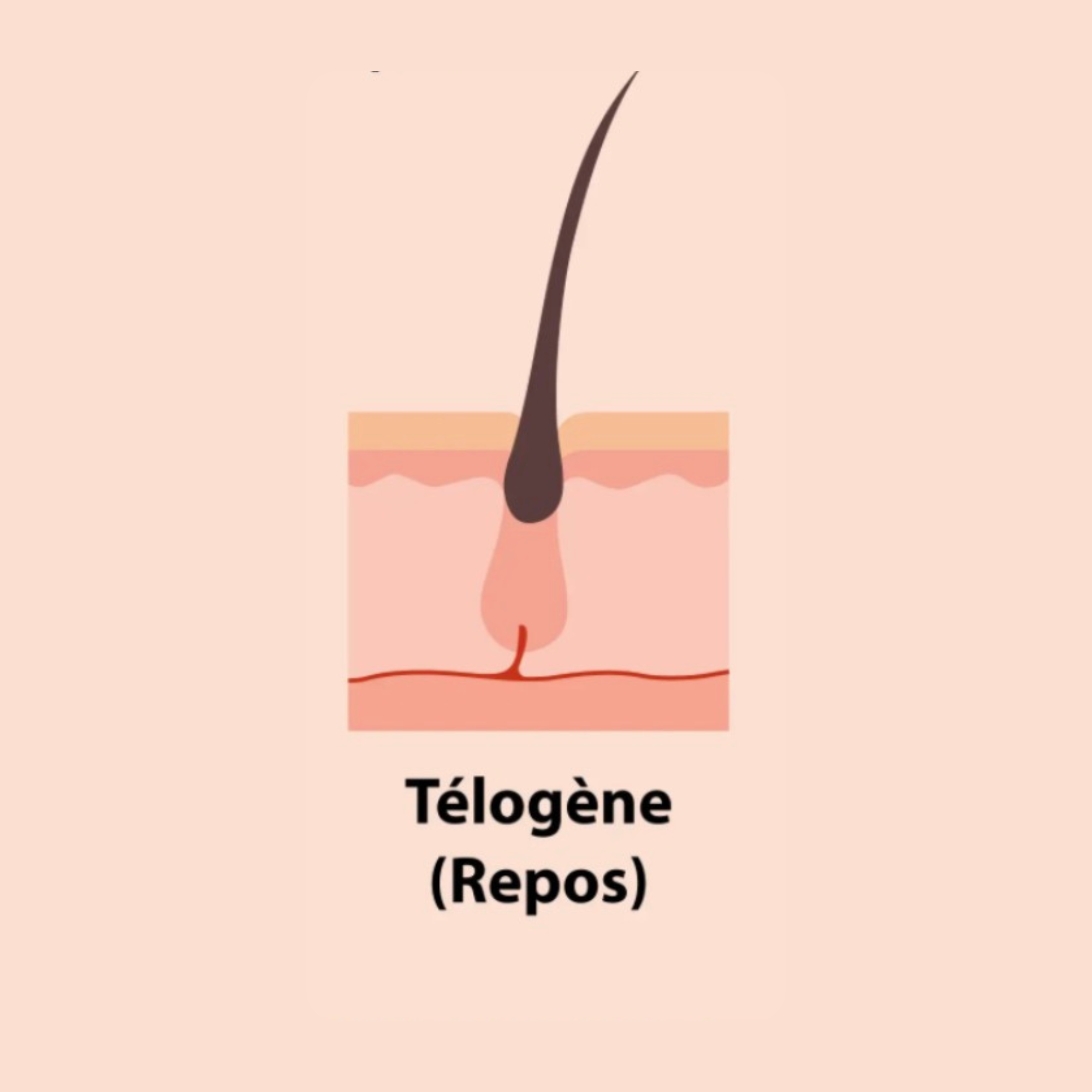 telogene