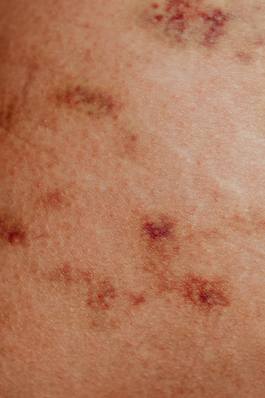 photos gratuites de bien etre condition de la peau corps humain