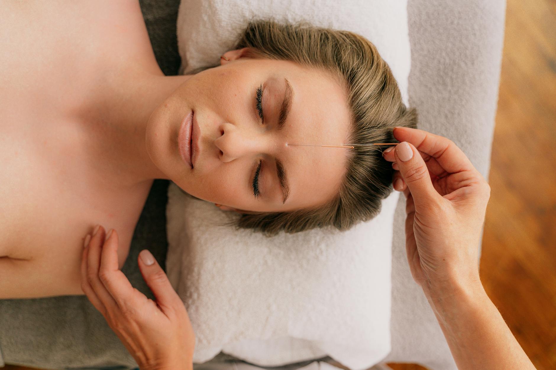 photos gratuites de acupuncteur acupuncture acupuncture de la tete