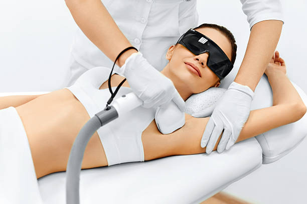 epiliation definitive
