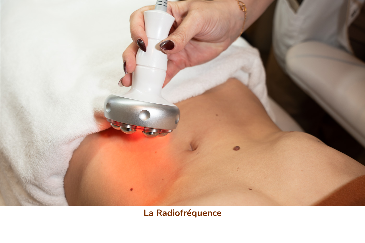 /radiofrequence.html