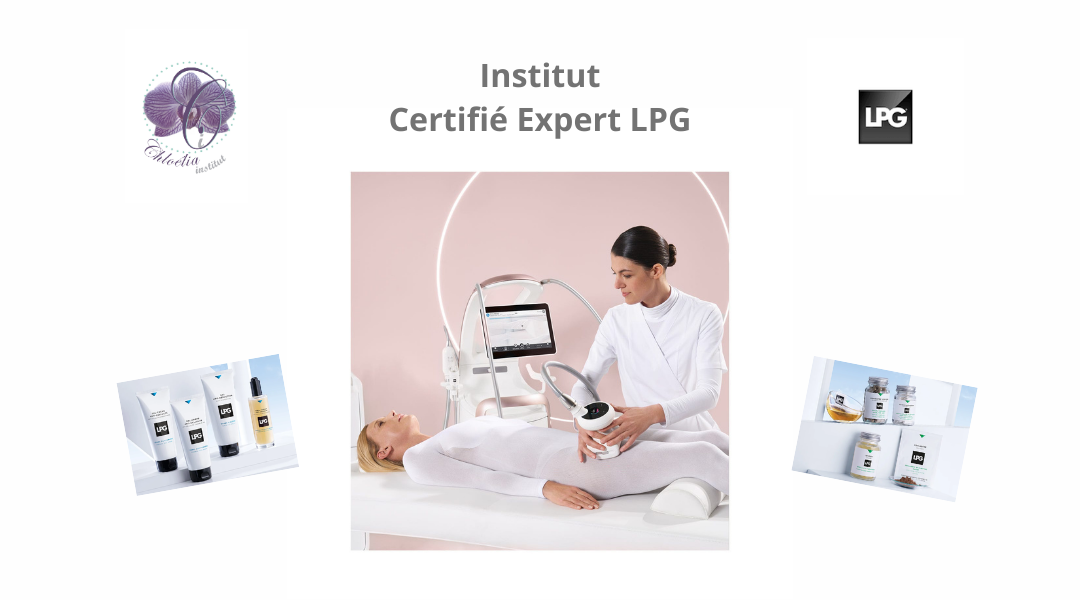 expert lpg planity