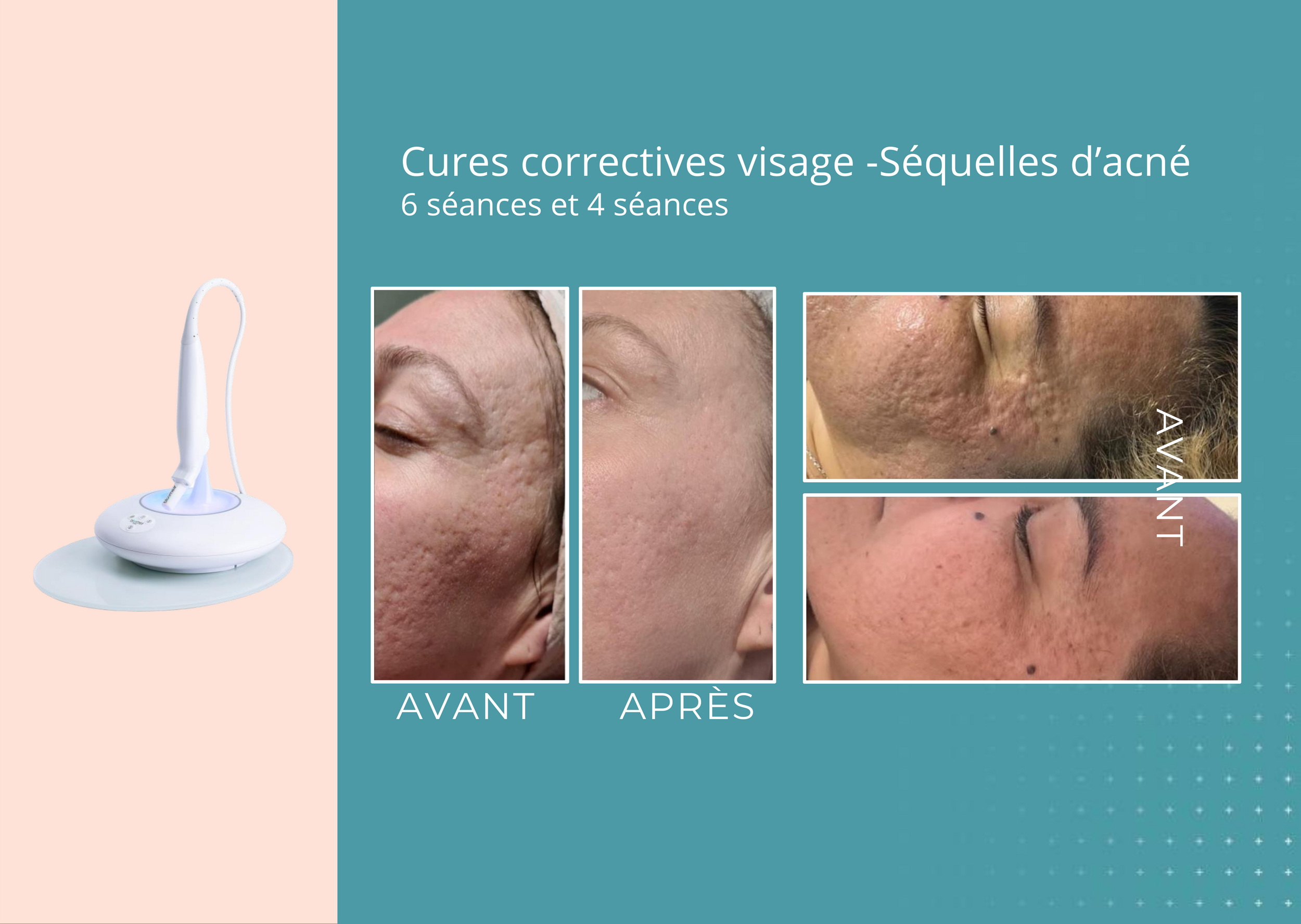 avant apres fontaine fr pdf 4