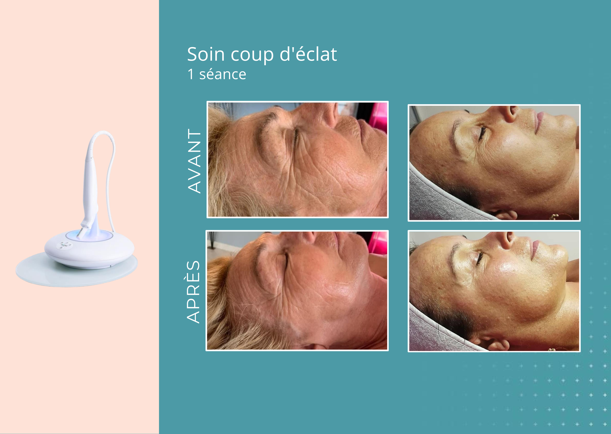 avant apres fontaine fr pdf