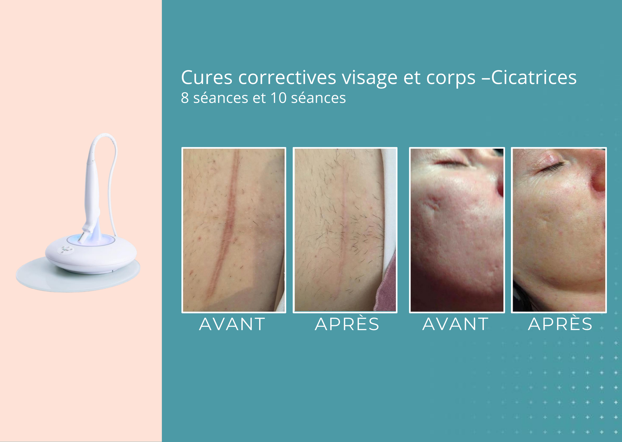 avant apres fontaine fr pdf 6