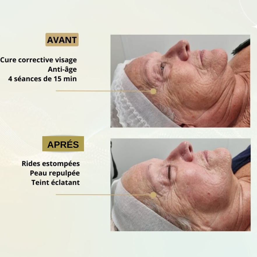 neocare elite soin corps visage