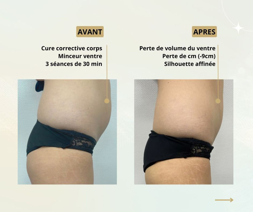 neocare elite soin corps