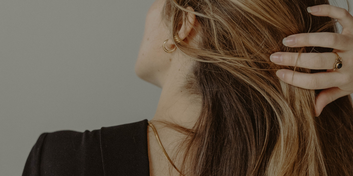 perte de cheveux calvitie implants capillaire lille