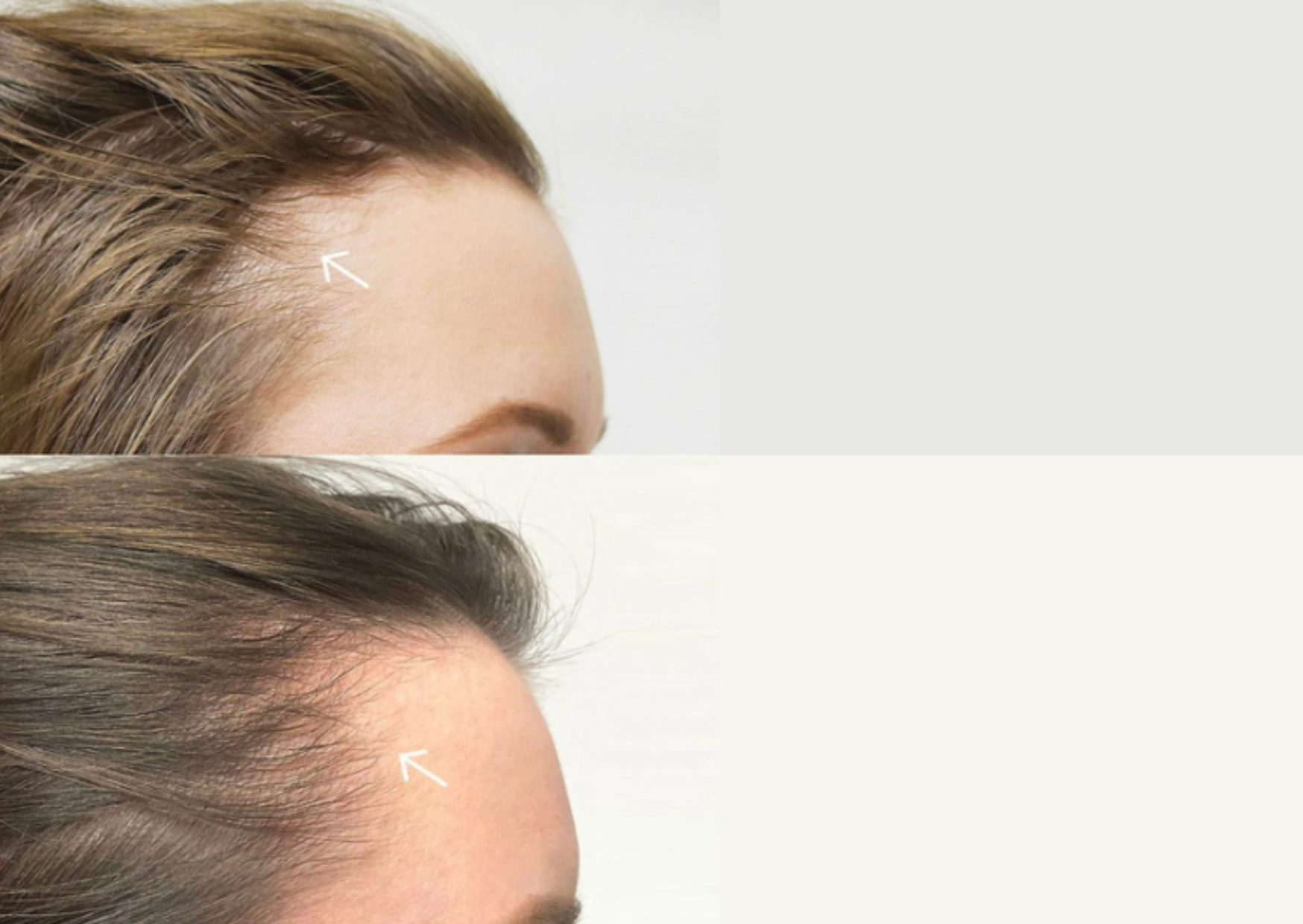 hair boost clinic 2