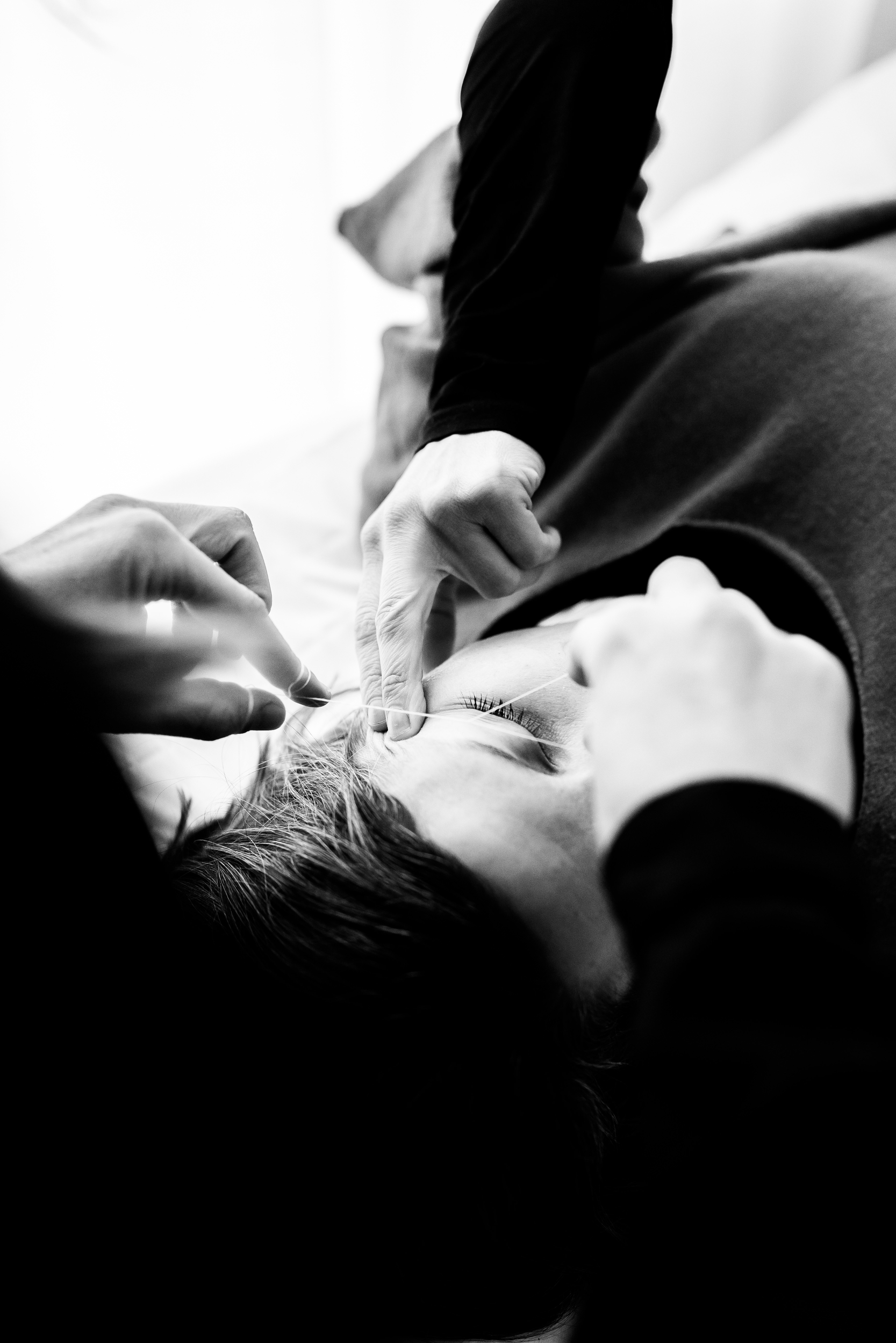 epilation