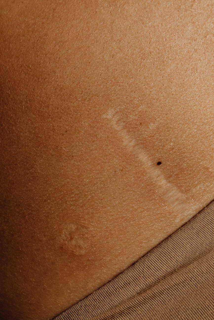 photos gratuites de acceptation de soi anatomie humaine authenticite