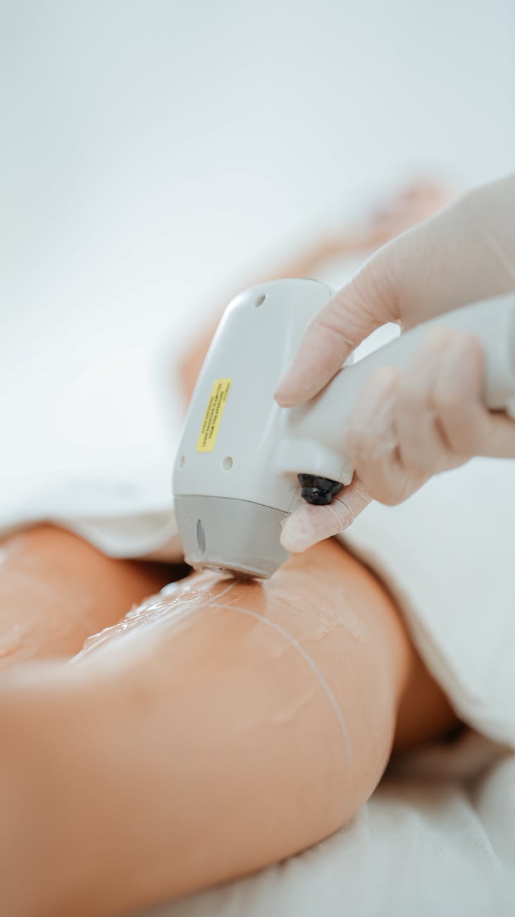 gros plan sur une procedure d epilation laser en milieu clinique pour un resultat cutane lisse