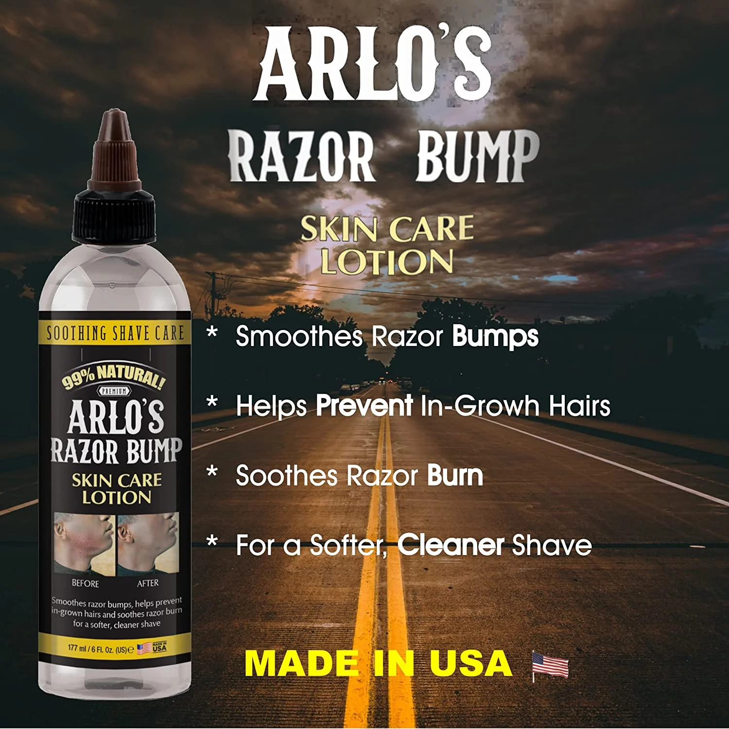 ARLOS RAZOR BUMPS