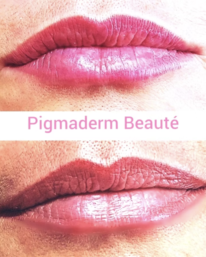 pigmaderm beaute