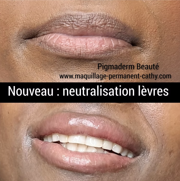 pigmaderm beaute