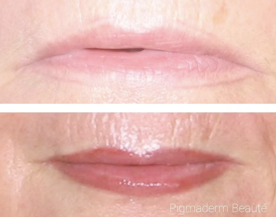 pigmaderm beaute