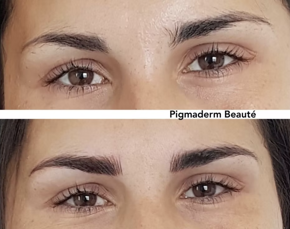 pigmaderm beaute