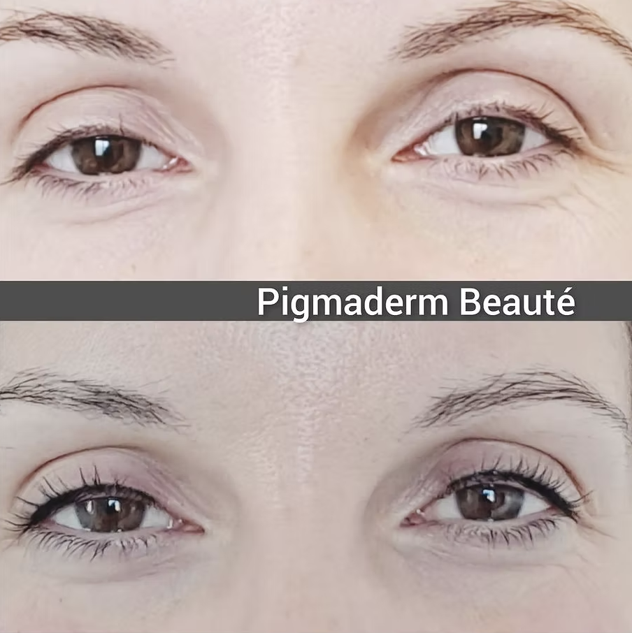 pigmaderm beaute