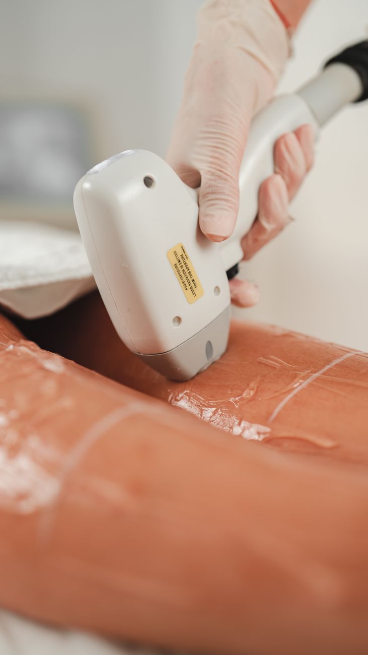 gros plan sur le processus d epilation au laser sur une jambe dans une clinique de beaute mettant en avant une technologie cosmetique avancee