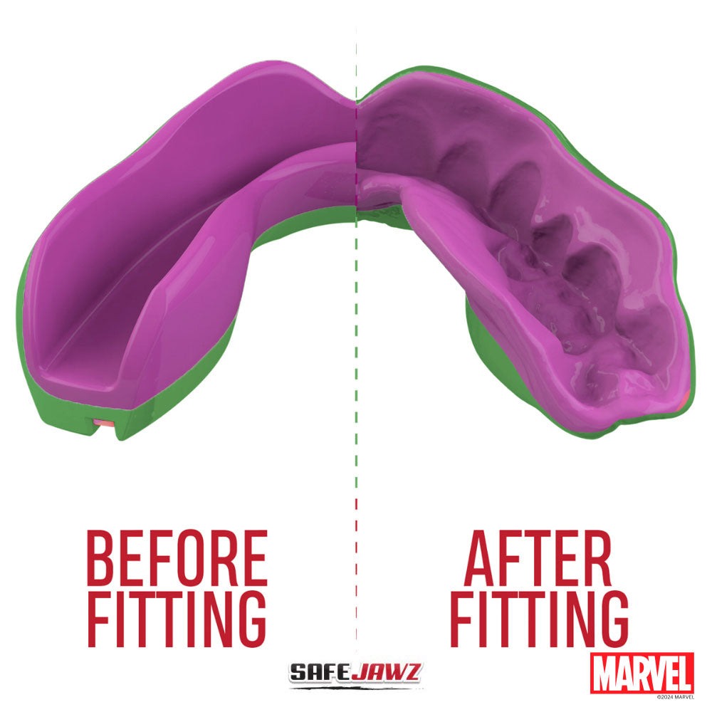 protege-dents-safe-jawz-hulks