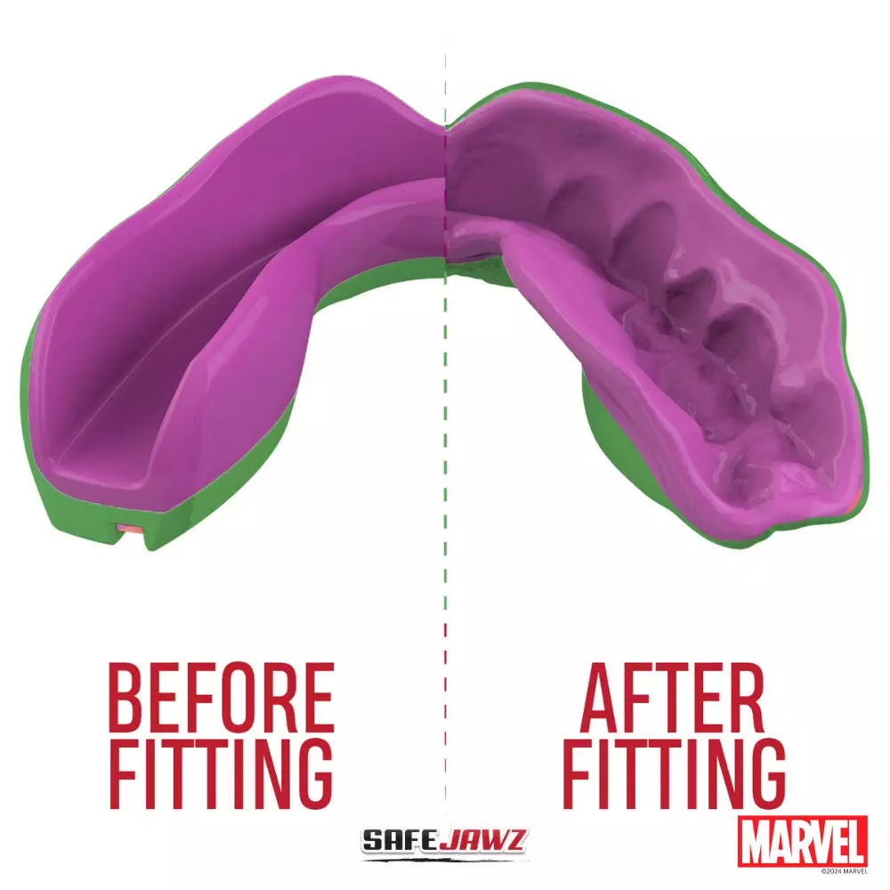 protege-dents-safe-jawz-hulks