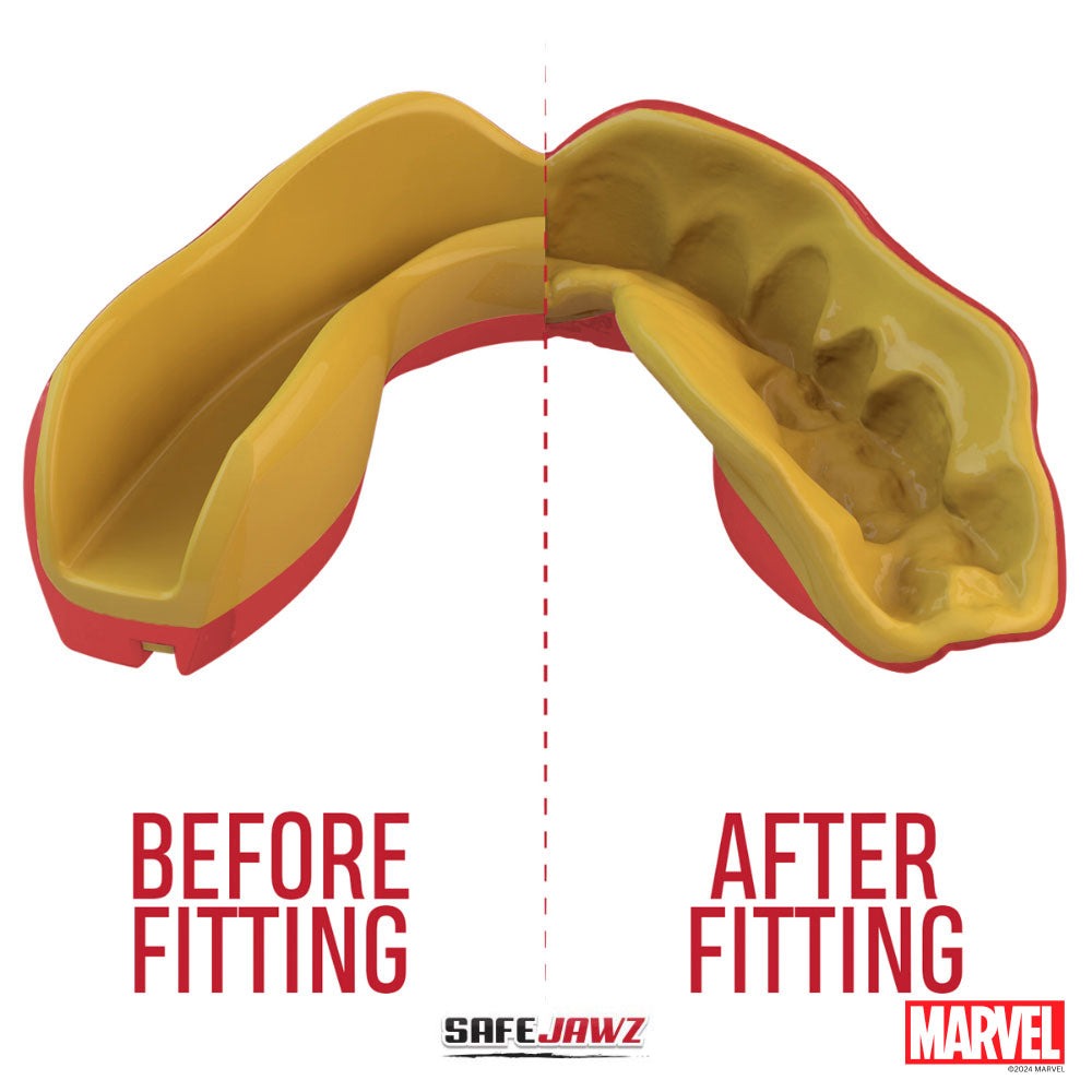 proteg-dents-safe-jawz-marvel-iron-man