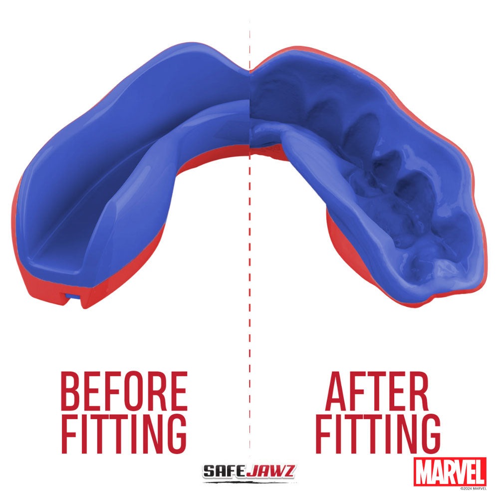 protege-dents-safe-jawz-spider