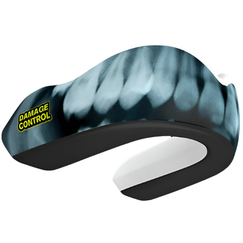 protege-dents-damage-control-x-ray