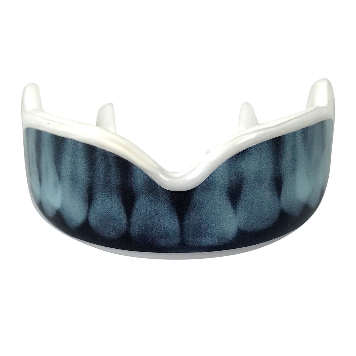 protege-dent-damage-control-x-ray