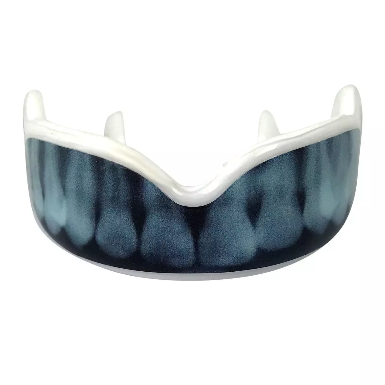 protege-dent-damage-control-x-ray