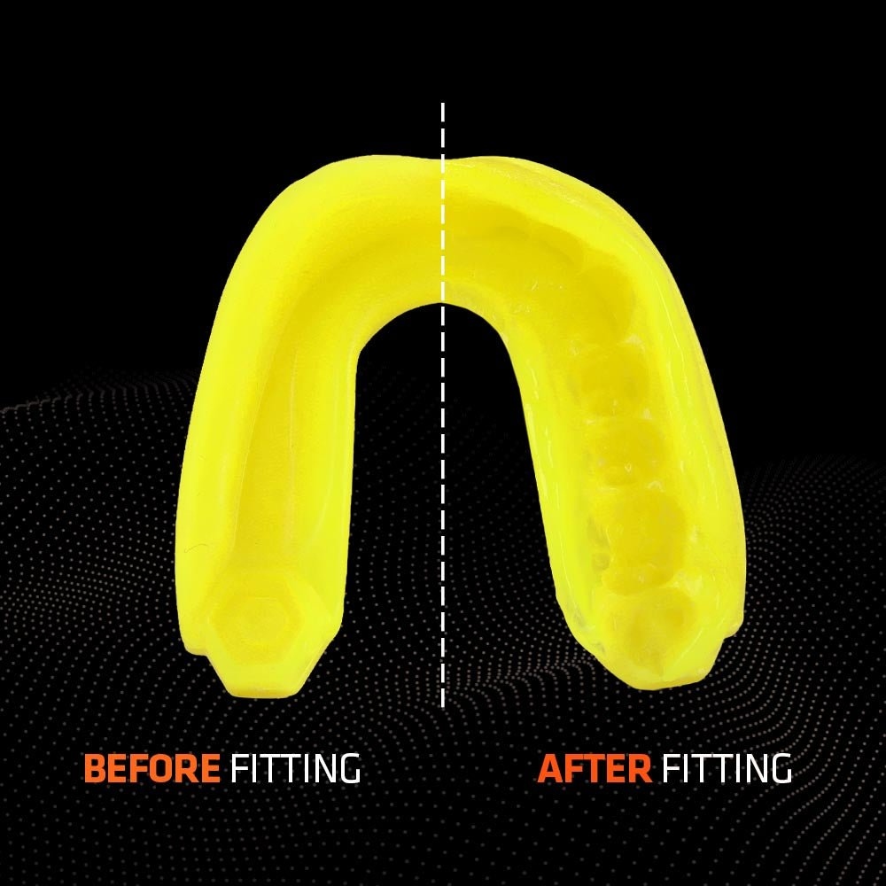 protege-dent-shok-doctor-gel-max-jaune-fluo