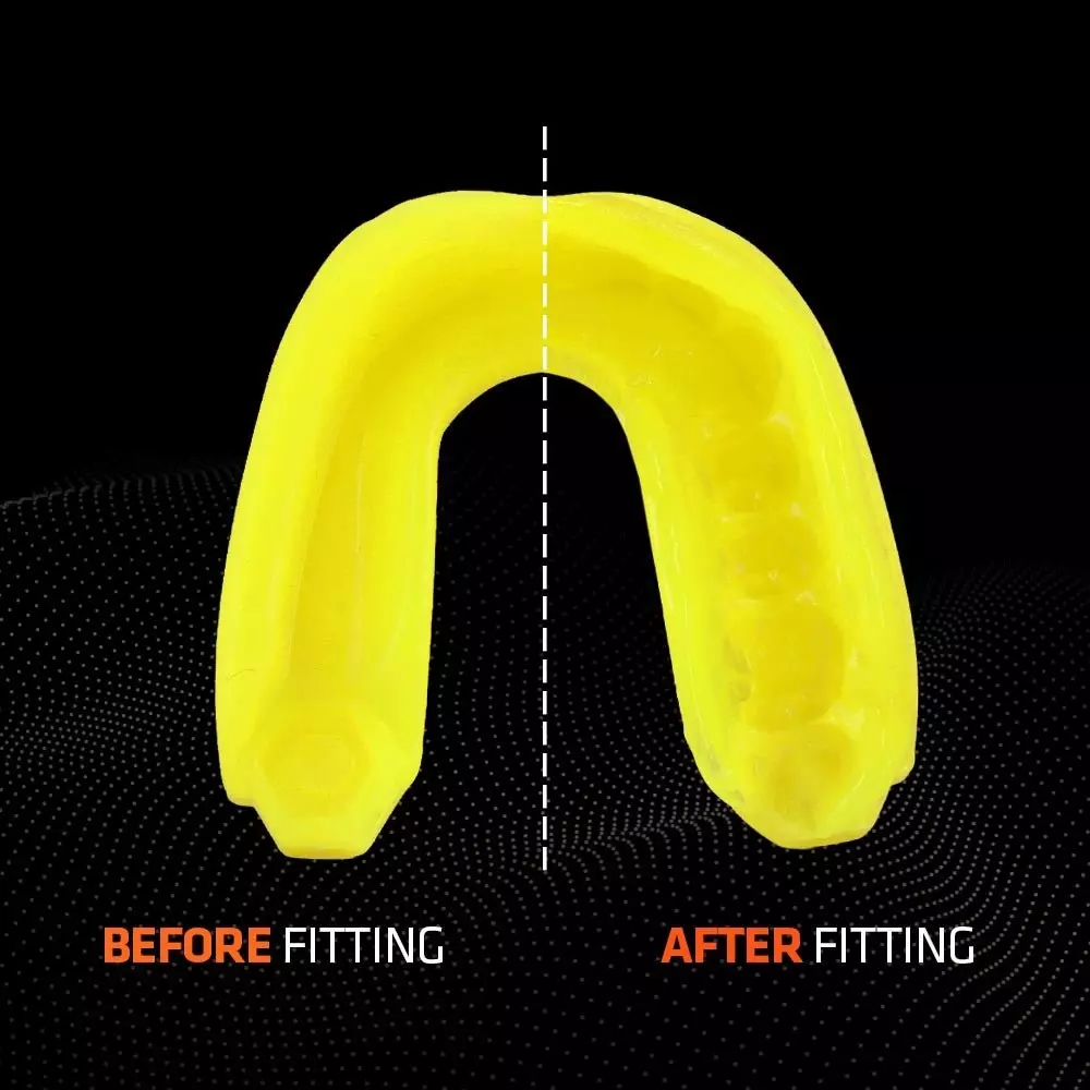 protege-dent-shok-doctor-gel-max-jaune-fluo