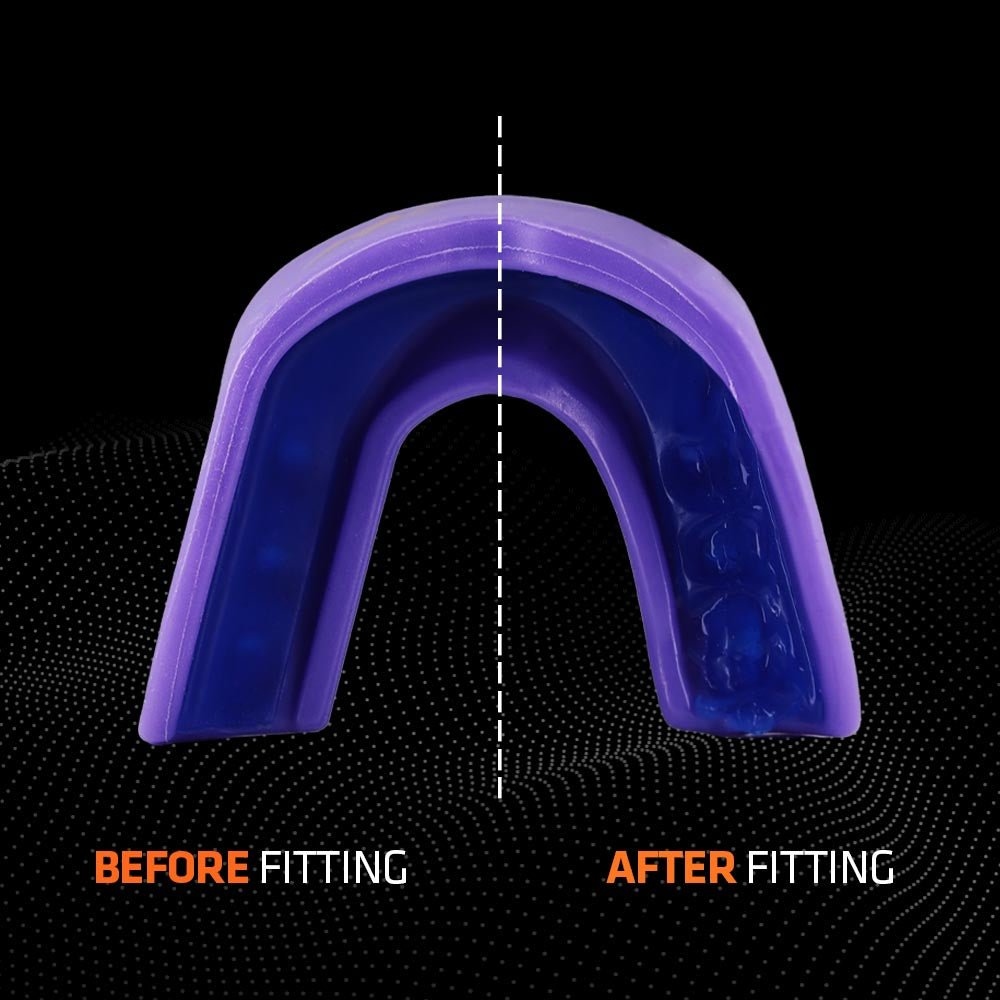 protege-dents-shock-doctor-gel-stike-violet