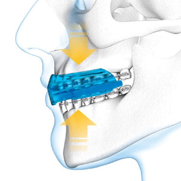 BOXE : comment se protéger les dents ? - Orthodontie & Dentiste Luxembourg  - Dudelange