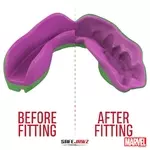 protege-dents-safe-jawz-hulks