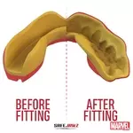 proteg-dents-safe-jawz-marvel-iron-man