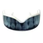 protege-dent-damage-control-x-ray
