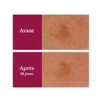 serum-concentre-anti-taches3