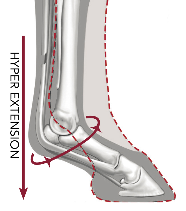 ultra support boots guêtres lemieux tendons