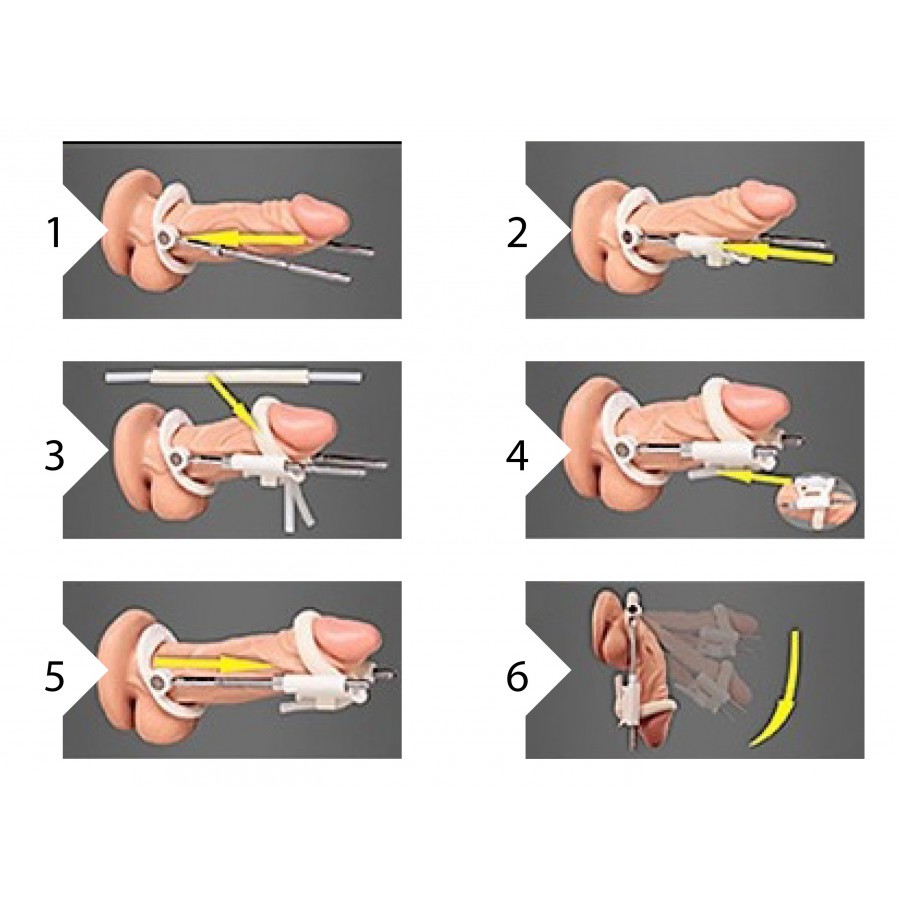 extenseur-de-penis-noir-extendeur-pro-4