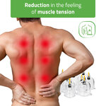 ventouses-therapeutiques-tensions-musculaires-dos-kinesitherapie-habys-tablelya