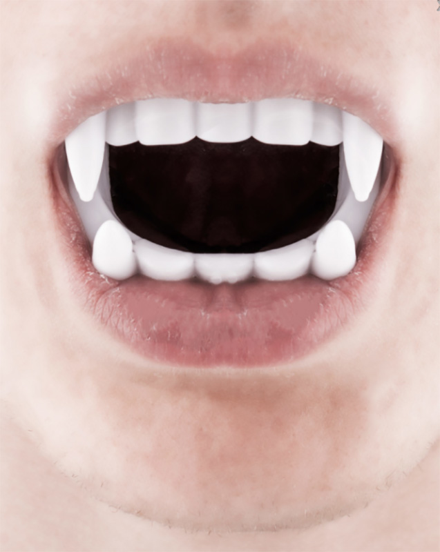 Dentier vampire enfant