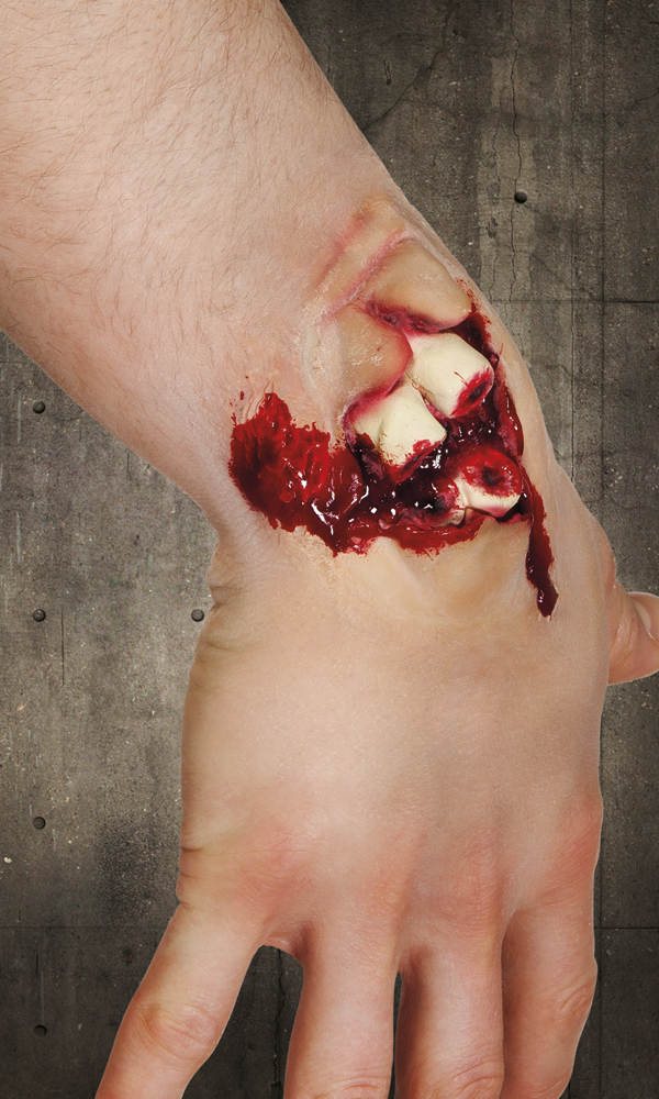 cicatrice latex fracture ouverte